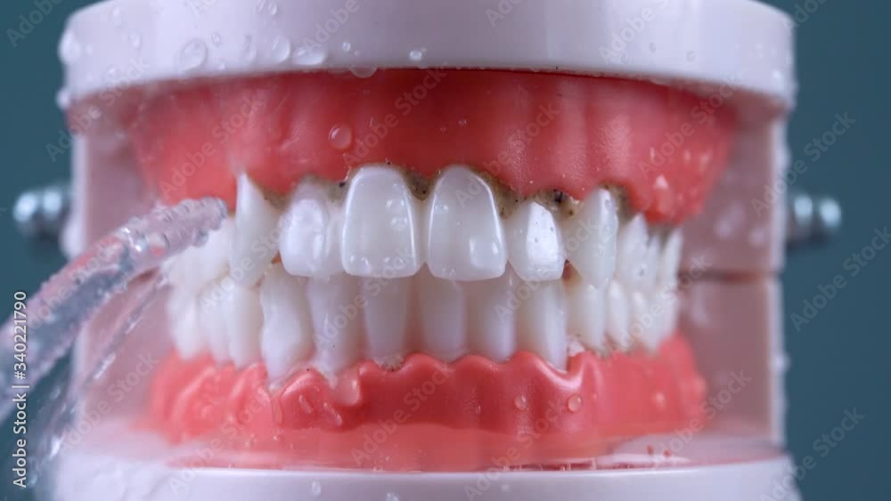Teeth Cleaning Water Pressure Tooth jaw. Brushing teeth with a dental