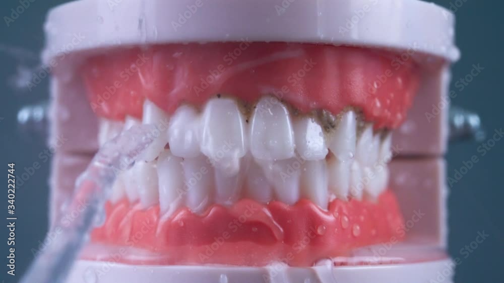 Teeth Cleaning Water Pressure Tooth jaw. Brushing teeth with a dental