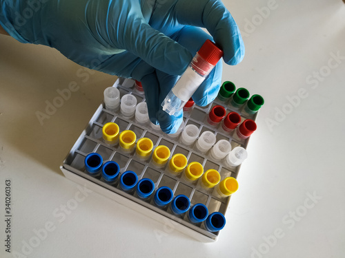 test tubes in laboratory, scientist working in laboratory