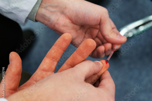Process of taking a patient s blood samples from a finger for analysis key indicators.