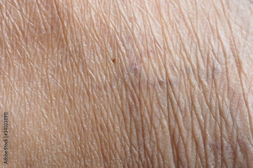 Closeup of wrinkles in Asian skin in deep layers. Skin repair and treatment concept for elderly and aged people. Healthcare, medical and aesthetic concept