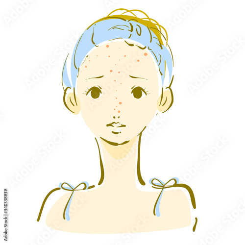 skincare, woman worried about acne