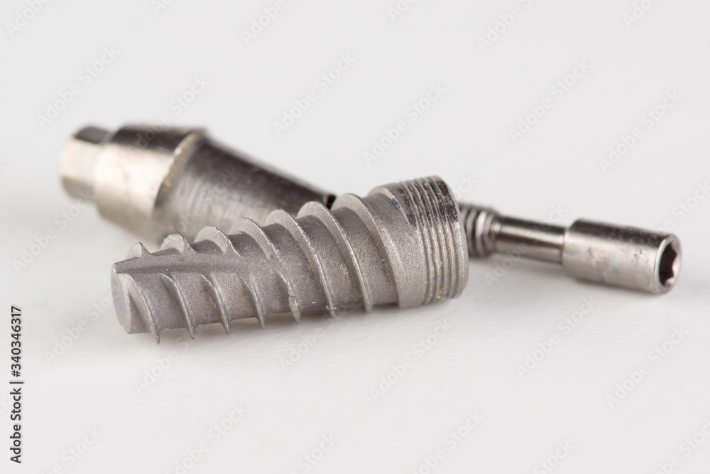 dental titanium implant with locking elements dental titanium implant with locking elements