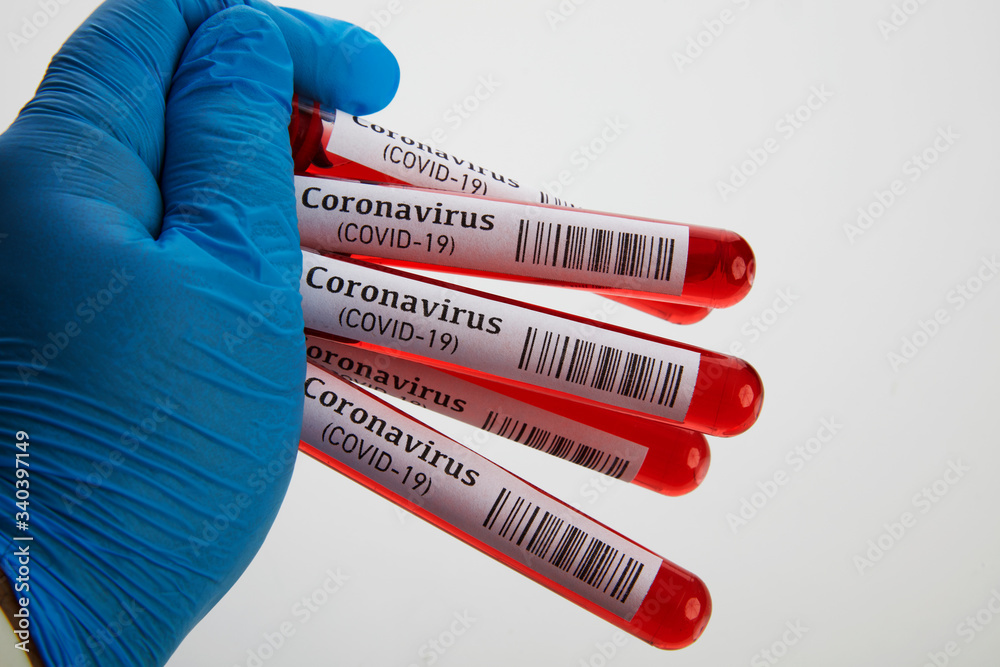 Obraz premium Coronavirus Blood Test in Laboratory