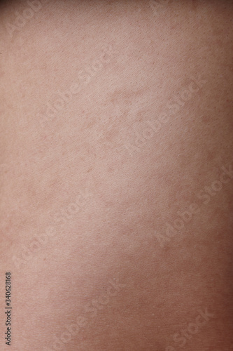a close-up shot of the dull, rough surface of the skin.