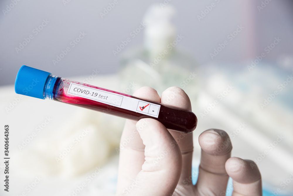 Obraz premium test tube, inscription virus, coronavirus study, virus research