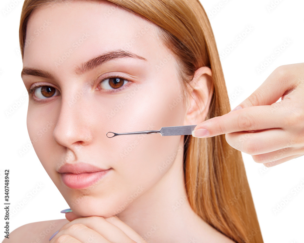 Young woman with acne loop. Squeeze the acne with acne spoon.