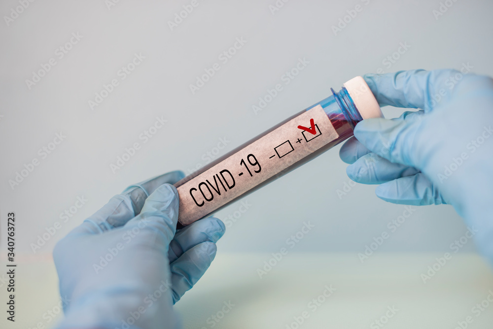 Obraz premium blood test coronavirus test in test tube with the result in the hands of a doctor of a virologist with medical gloves