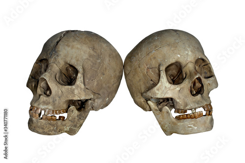 Fake human skulls with crack down head