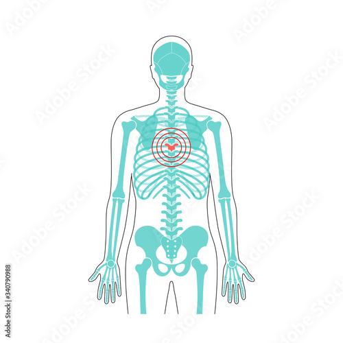 Human spine pain vector illustration