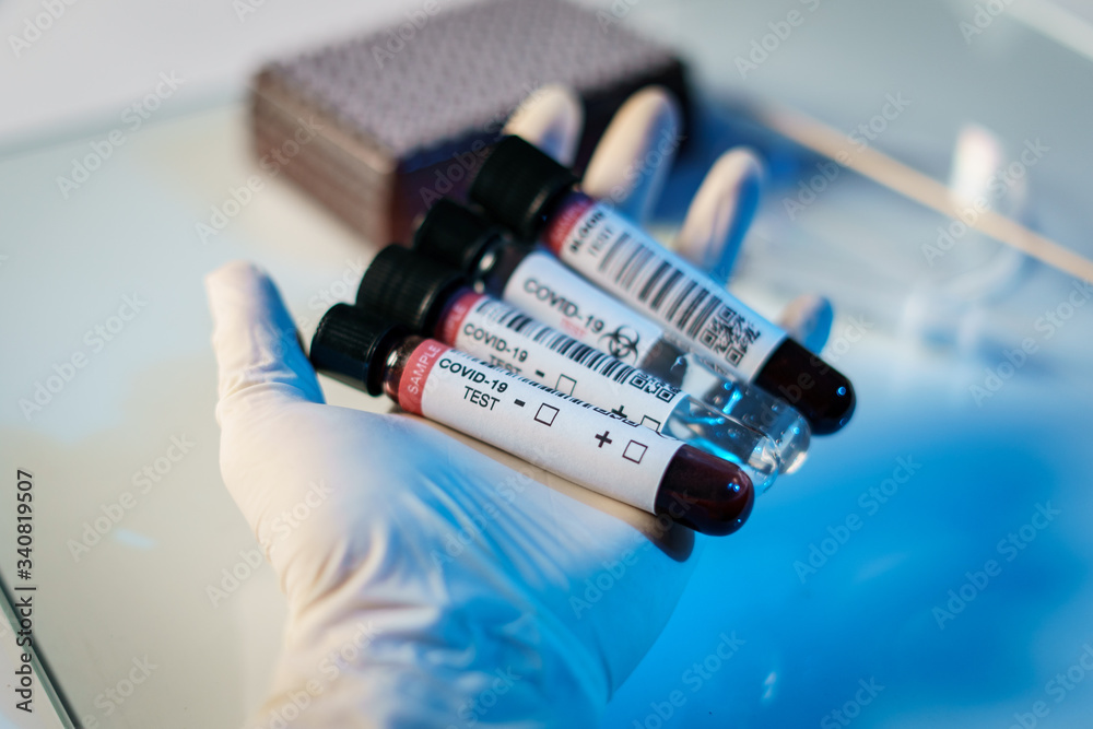 Coronavirus testing process, a hand holds tube of blood test samples and swab collection kit specimen sample testing.