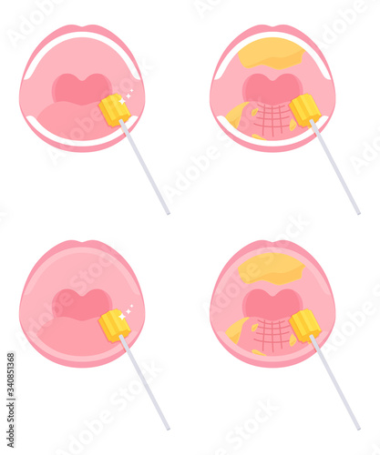 口腔ケアのイラスト スポンジブラシ セット Stock Vector Adobe Stock 口腔ケアのイラスト スポンジブラシ セット Stock Vector Adobe Stock