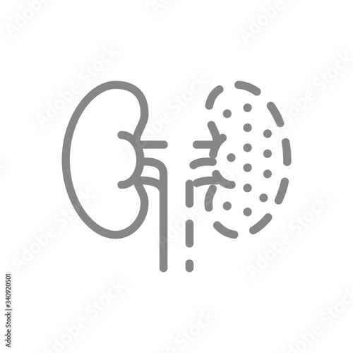 Kidneys amputation line icon. Nephrectomy, one kidney symbol