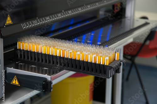 Biochemical automatic analyzer.