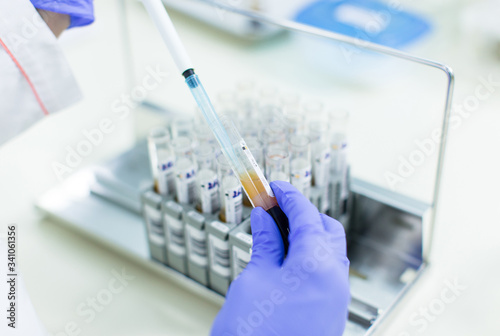 blood test