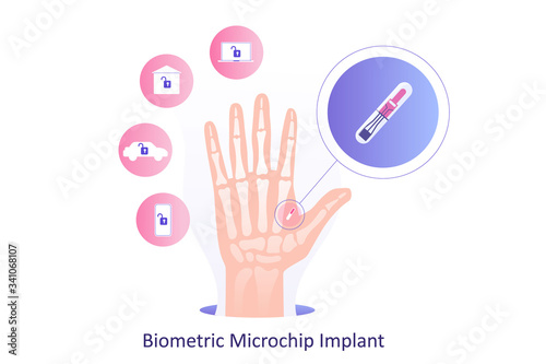 Biometric microchip implants for humans. Microchip implanting inside of a huge hand. Controlling devices with RFID (Radio-frequency identification) technology concept. Isolated vector illustration.