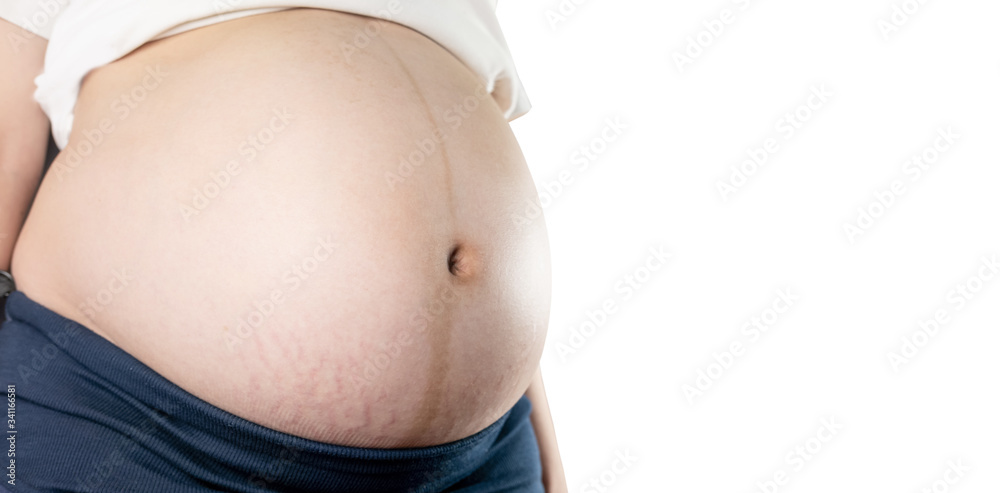 custom made wallpaper toronto digitalthe strech marks on pregnant woman belly