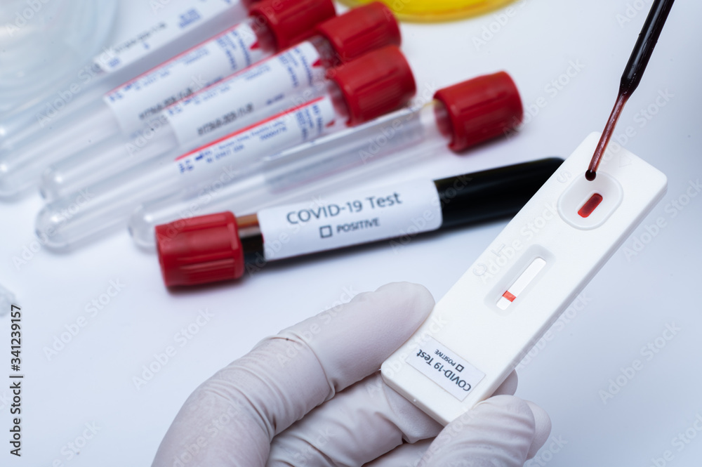 Lab Drop the blood into the covid-19 test kit. for check the patient and bring to treat the disease on hospital. Lab Drop the blood into the covid-19 test kit. for check the patient and bring to treat the disease on hospital.