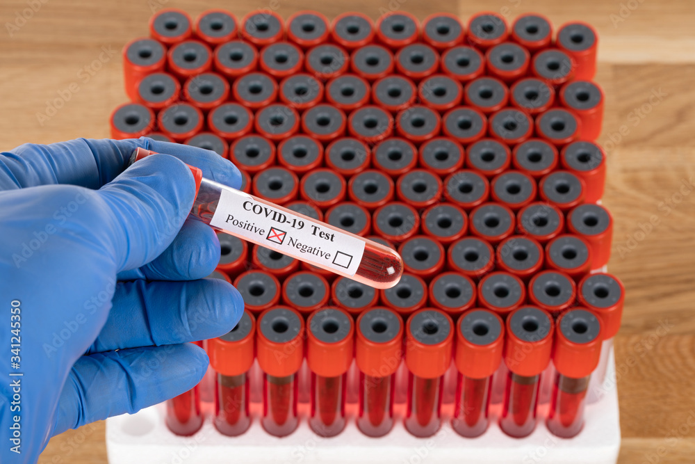 Fototapeta premium Covid-19 blood samples