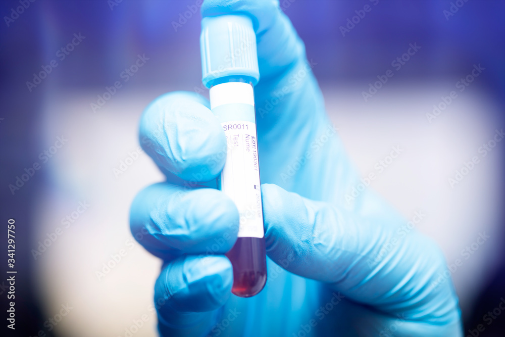 COVID-19 - Coronavirus disease - 2019-nCoV. COVID-19 - Coronavirus disease - 2019-nCoV.