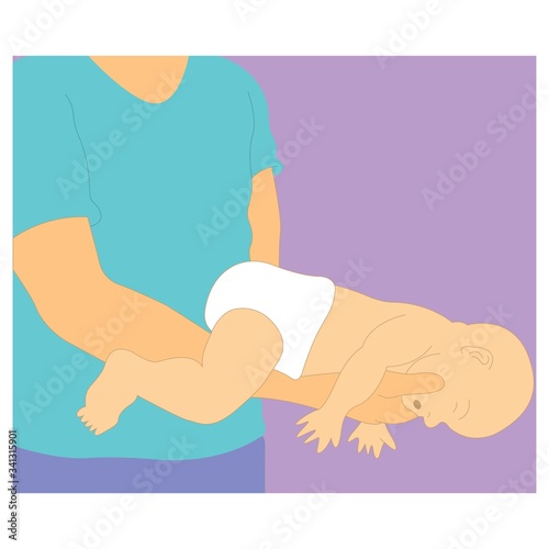 How to give first aid for newborns in case of chocking