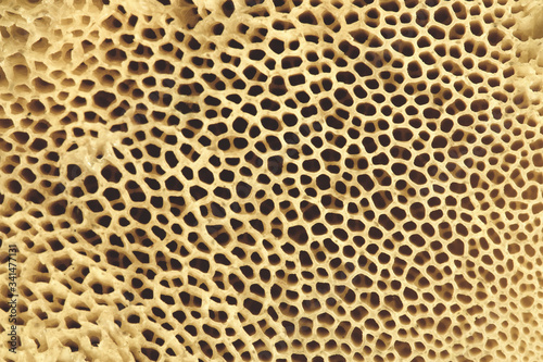 Bone structure. Bone tissue close-up. Osteoporosis.