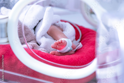 Newborn  in incubator ICU