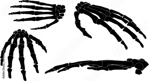 4 different views of forearm in black and white