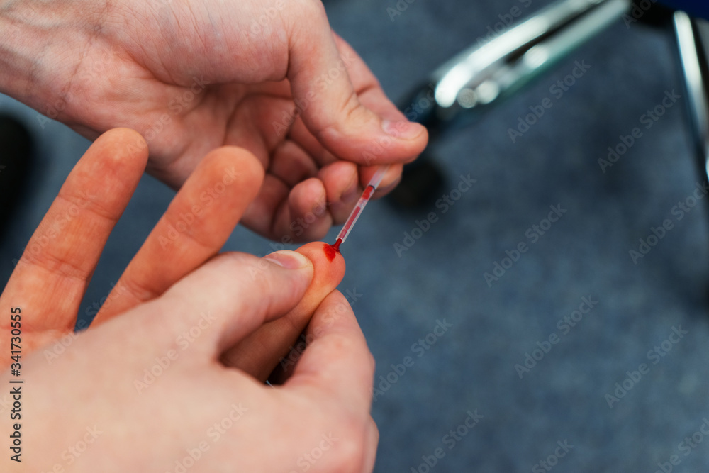 Process of taking a patient s blood samples from a finger for analysis key indicators. Process of taking a patient s blood samples from a finger for analysis key indicators.