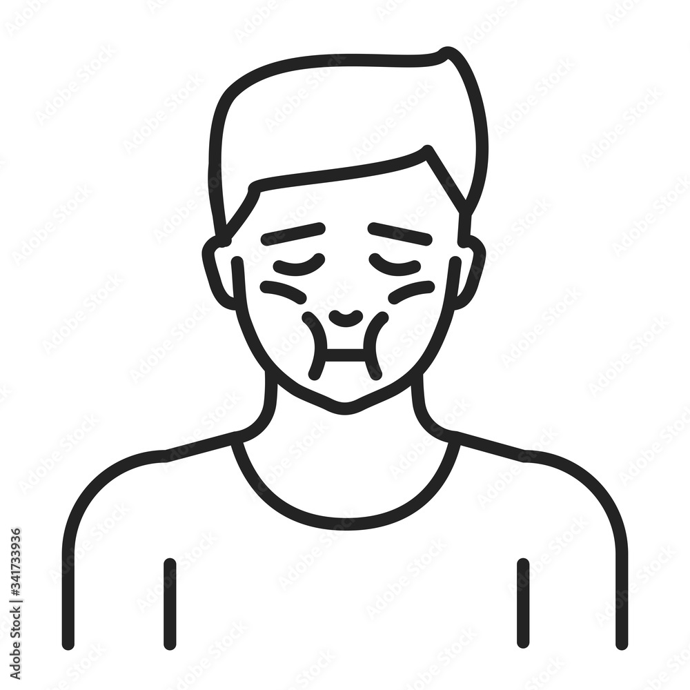Face swelling line black icon. Allergy symptom. Pictogram for web page, mobile app, promo. UI UX GUI design element. Editable stroke. Face swelling line black icon. Allergy symptom. Pictogram for web page, mobile app, promo. UI UX GUI design element. Editable stroke.