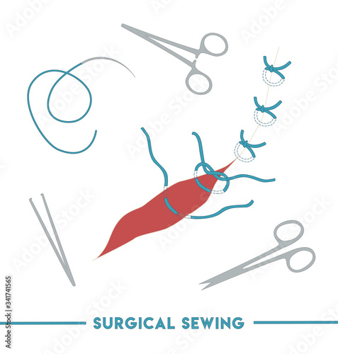 suture, stitch, surgical, medical, wound, sewing, treatment, anxiety, doctor, medical stuff, needle