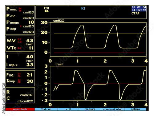 Screen, monitor with signs of the artificial lung ventilation device in a realistic design. Isolated vector