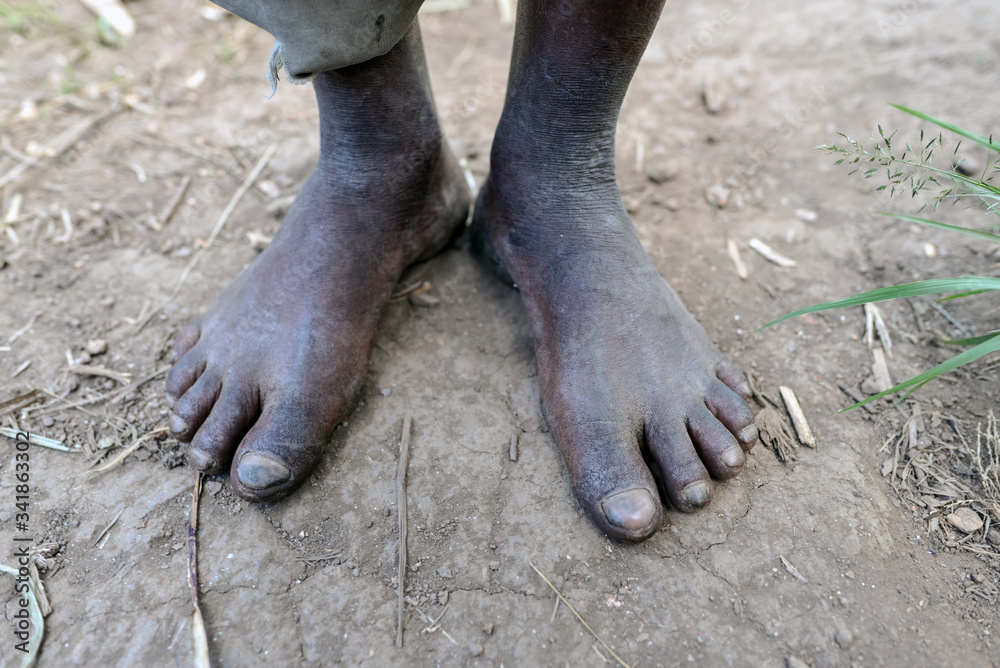 Detail of strong black feet of African man standing on soil ground