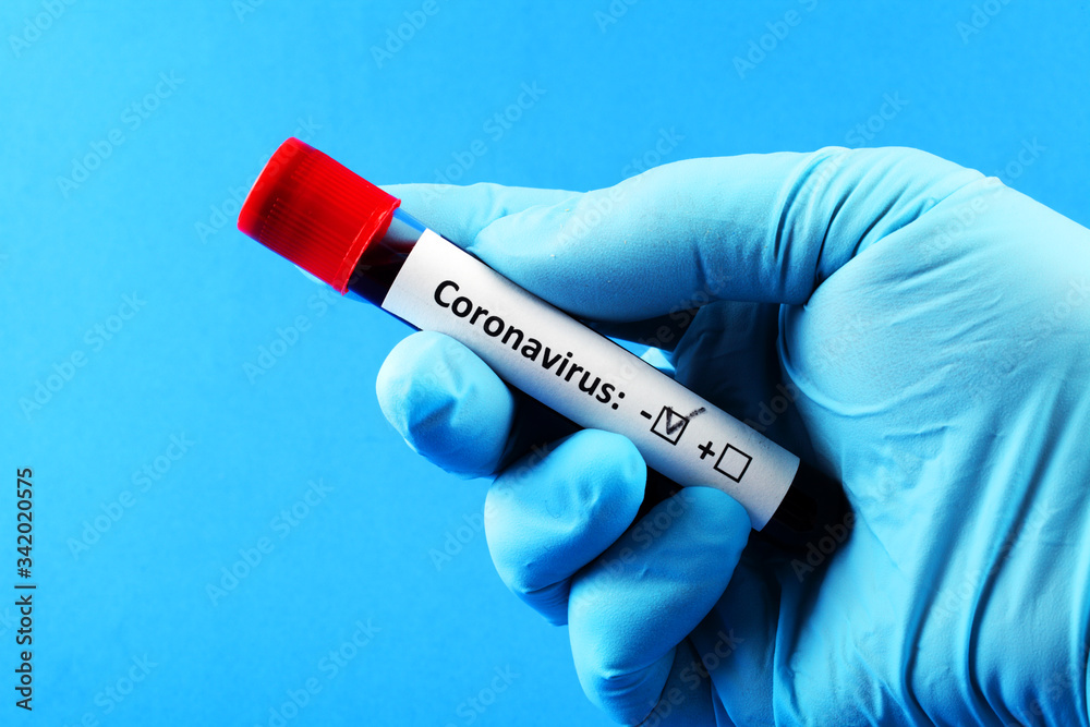 Fototapeta premium Coronavirus. Doctor's hand in a blue glove. Blood sample in vitro for analysis. Blue background.