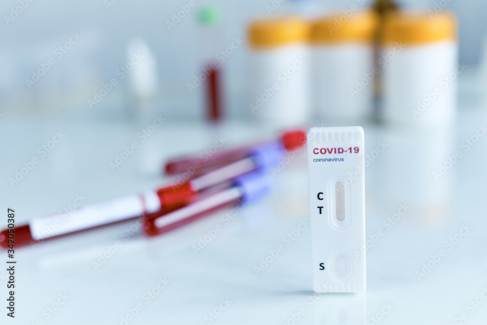 Tests for COVID-19, lab card kit test for viral influenza.