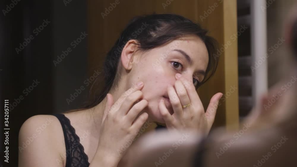 A proud smiling pretty young woman looks at her blemishes. A woman looks at the redness on her face in the bathroom mirror of her home. Hygiene, aesthetics, makeup, facial care. Close up A proud smiling pretty young woman looks at her blemishes. A woman looks at the redness on her face in the bathroom mirror of her home. Hygiene, aesthetics, makeup, facial care. Close up