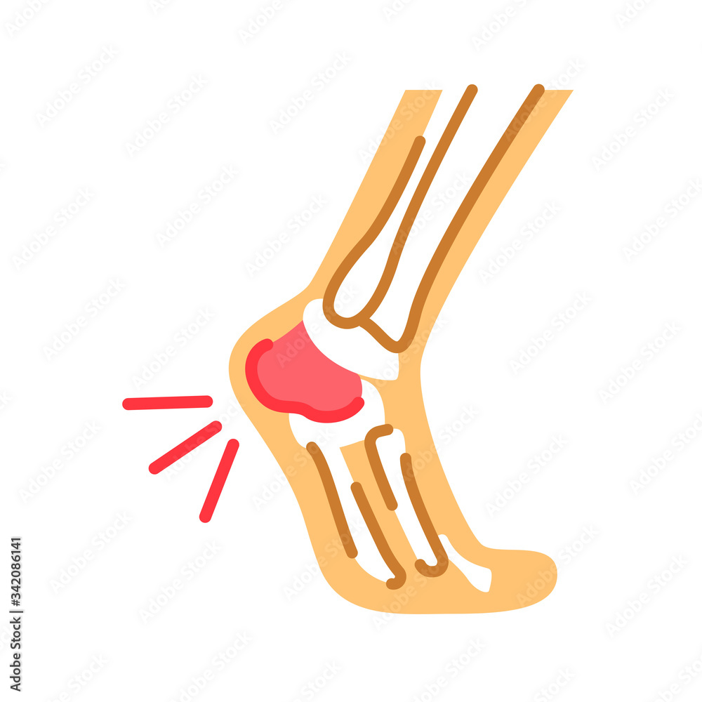 Foot heel pain flat color icon. Heel spur, calcaneal apophysitis, plantar fasciitis, disease concept. Sign for web page, mobile app, button, logo. Vector isolated button