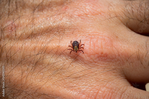 Mite tick. A tipical summer parasite in Europe. May cause several dangerouse infections and illness like erlechiosis, encephalitis, potomac fever and others photo