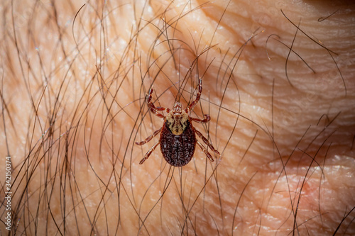 Mite tick. A tipical summer parasite in Europe. May cause several dangerouse infections and illness like erlechiosis, encephalitis, potomac fever and others photo