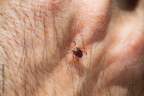 Mite tick. A tipical summer parasite in Europe. May cause several dangerouse infections and illness like erlechiosis, encephalitis, potomac fever and others photo