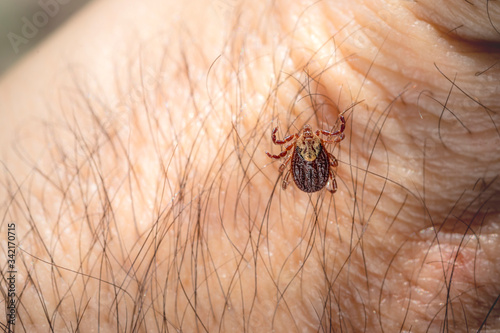 Mite tick. A tipical summer parasite in Europe. May cause several dangerouse infections and illness like erlechiosis, encephalitis, potomac fever and others photo