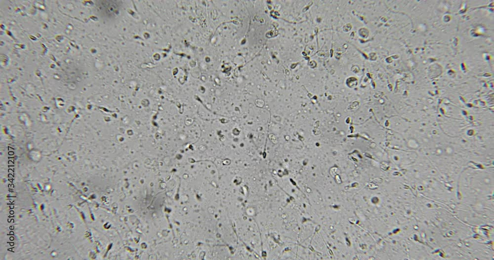 Human semen in phase contrast microscope
