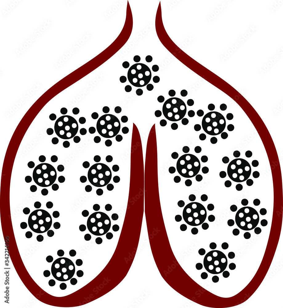 schematic representation of the lungs with the coronavirus schematic representation of the lungs with the coronavirus
