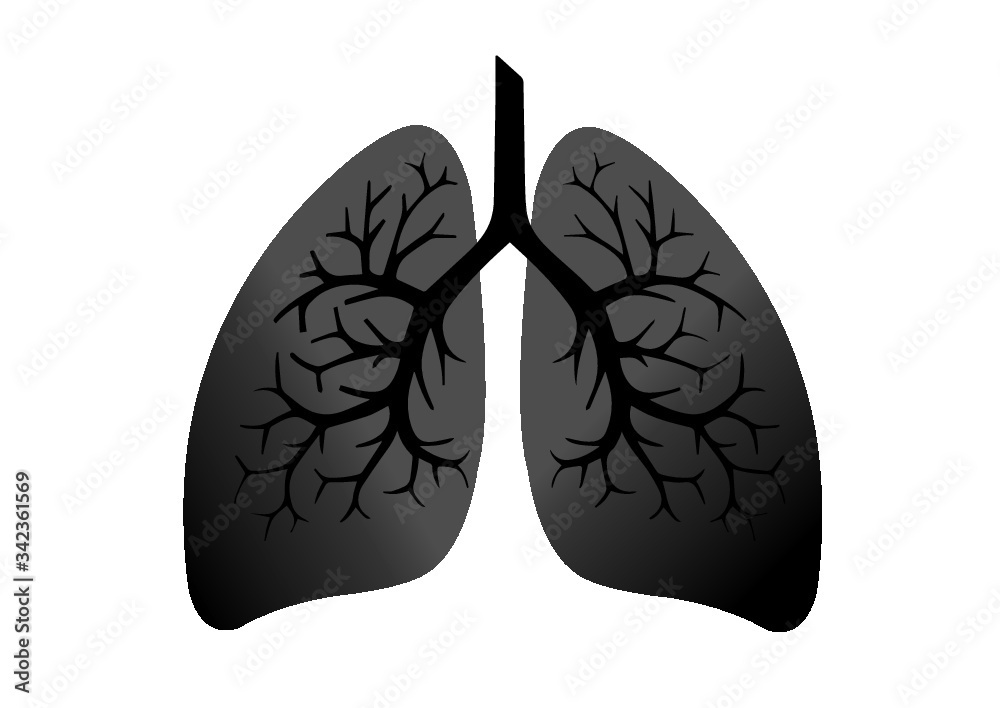 Comparison between healthy lung and cancer lung isolated on white ...