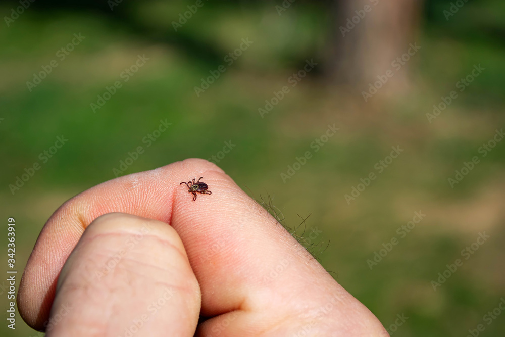 Obraz premium tick on human skin on the background of the forest