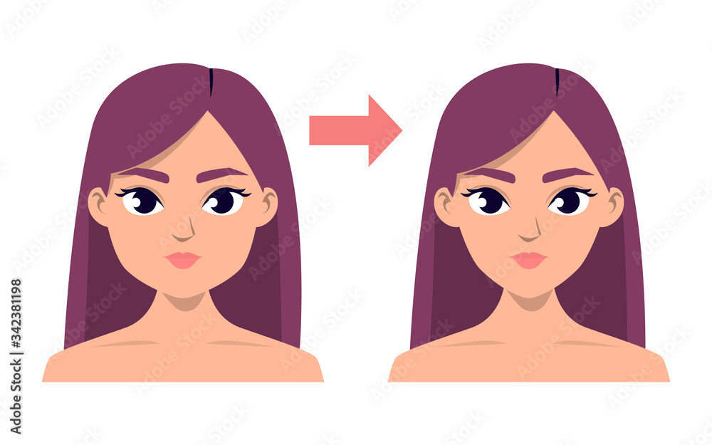 Face contour plastic surgery vector isolated illustration Face contour plastic surgery vector isolated illustration