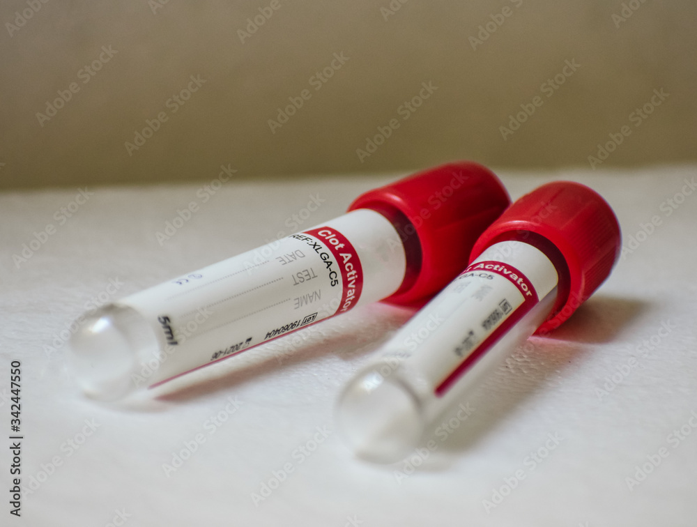 view of testing medical vials useful in various blood sample collections view of testing medical vials useful in various blood sample collections