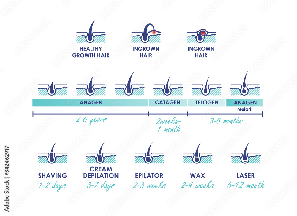 Healthy growth hair. Ingrown hair. Hair growth phases. Different methods of hair removal. Types