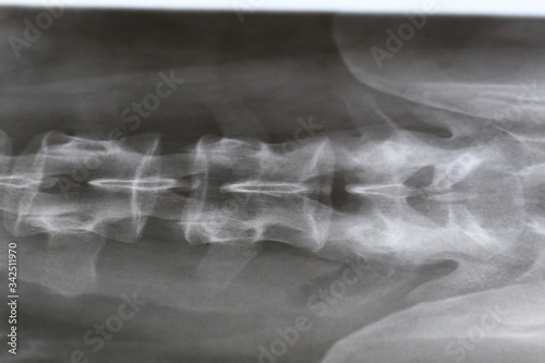 Human spinal cord x-ray image for healthcare 