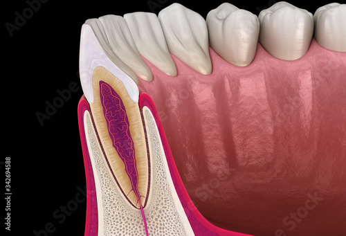 Anatomy of maxillary lateral incisor tooth and gum (cross section). Medically accurate dental 3D illustration